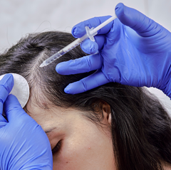 Can Medication Cause Hair Loss? Understanding the Impact on Your Hair  with Keshavya Hair
